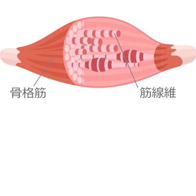 筋硬結の図